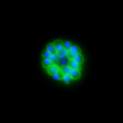 Schizont showing surface GFP expression