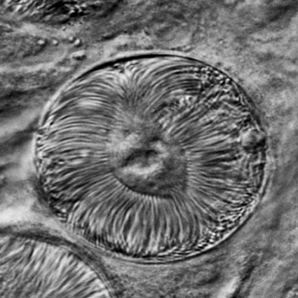 Oocyst with sporozoites